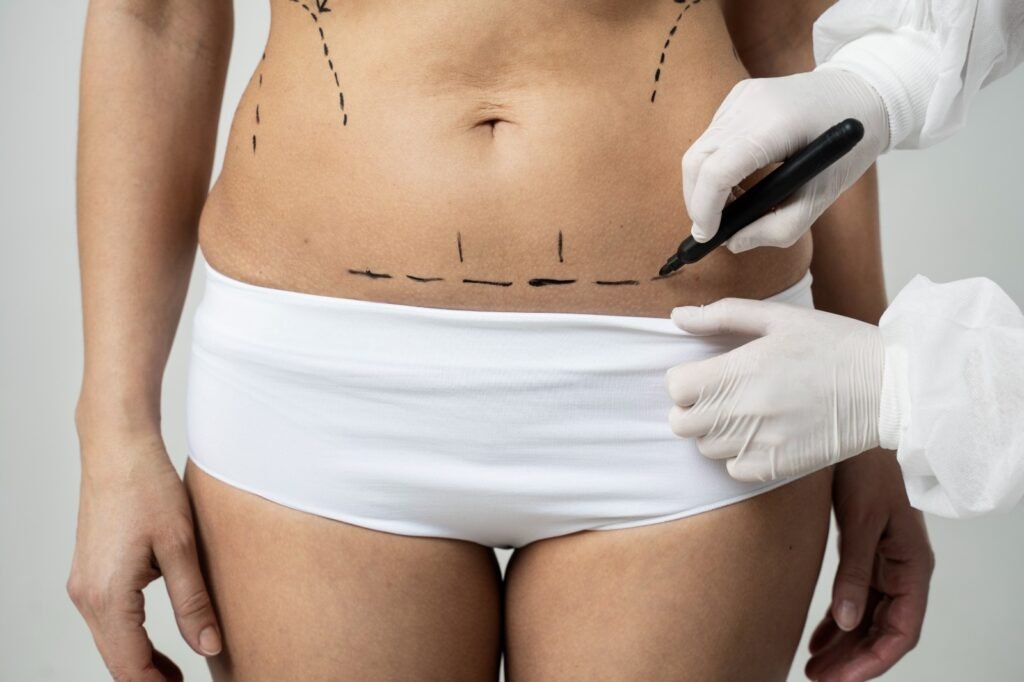 What Is Monsplasty? Benefits, Procedure, and Recovery Guide