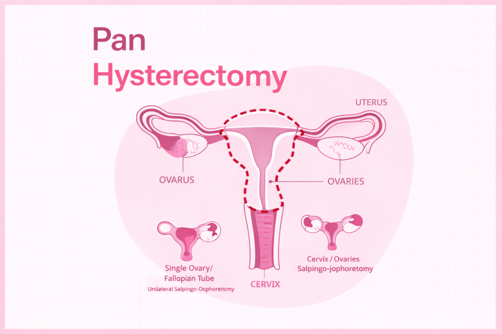 Pan Hysterectomy
